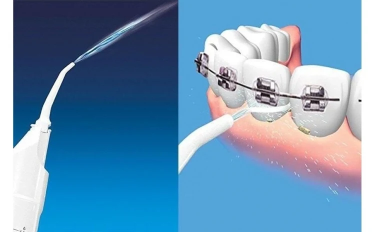 set 2x Aparat de curatare interdentara - irigator bucal
