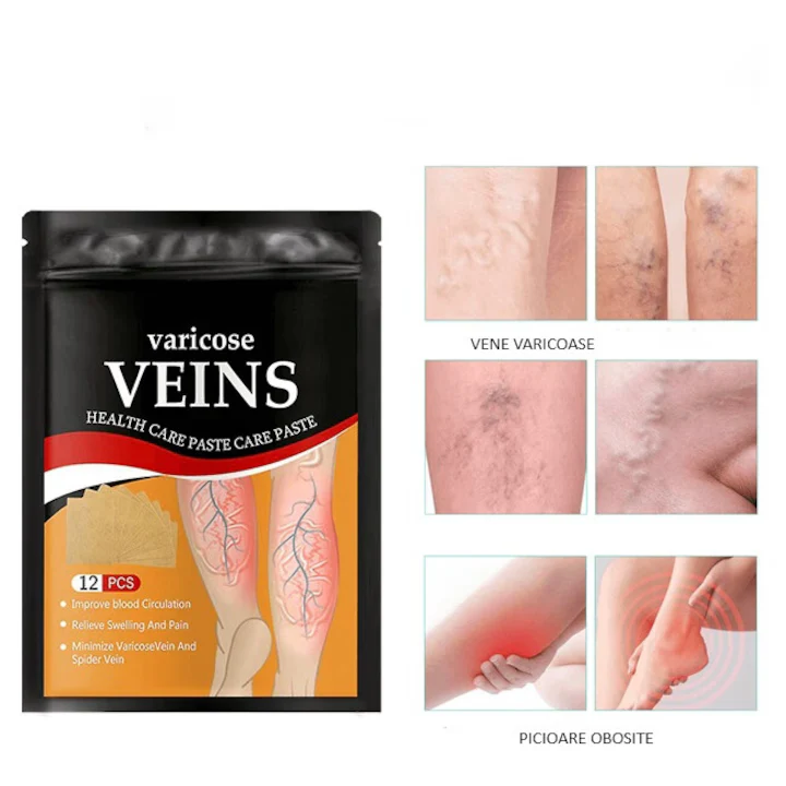 Set 1+1 Plasturi pentru varice, vene varicoase